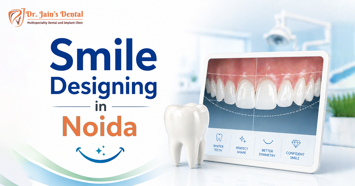 Smile Designing in Noida – Dr Jain’s Dental